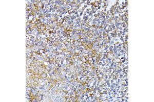 Immunohistochemistry of paraffin-embedded human tonsil using EIF2B2 antibody (ABIN6132131, ABIN6140037, ABIN6140038 and ABIN6222805) at dilution of 1:100 (40x lens).
