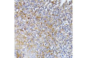 Immunohistochemistry of paraffin-embedded human tonsil using EIF2B2 antibody (ABIN6132131, ABIN6140037, ABIN6140038 and ABIN6222805) at dilution of 1:100 (40x lens). (EIF2B2 antibody  (AA 1-351))
