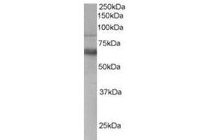 Image no. 1 for anti-anthrax Toxin Receptor 1 (ANTXR1) (C-Term) antibody (ABIN374464) (ANTXR1 antibody  (C-Term))