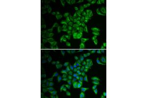 Immunofluorescence analysis of A549 cell using FXN antibody. (Frataxin antibody)