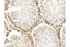 anti-Cancer Susceptibility Candidate 5 (CASC5) (Internal Region) antibody