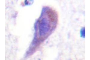 Immunohistochemistry analyzes of HRS Antibody in paraffin-embedded human brain tissue. (HGS antibody)