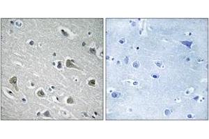 Immunohistochemistry analysis of paraffin-embedded human brain tissue, using MYLIP Antibody.
