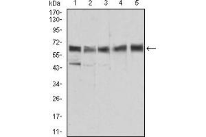 Western Blotting (WB) image for anti-Aldehyde Dehydrogenase 6 Family, Member A1 (ALDH6A1) (AA 1-195) antibody (ABIN5856297) (ALDH6A1 antibody  (AA 1-195))