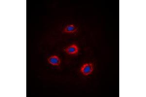 Immunofluorescent analysis of Alpha-adducin staining in HEK293 cells. (alpha Adducin antibody  (C-Term))