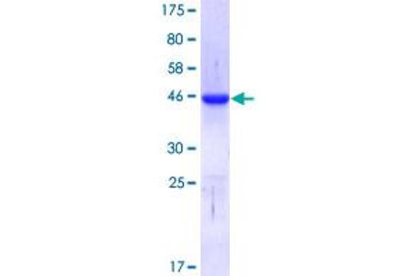 CTCF Protein (AA 1-100) (GST tag)