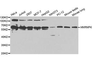 Western blot analysis of extracts of various cell lines, using HNRNPK antibody (ABIN5970850) at 1/1000 dilution.