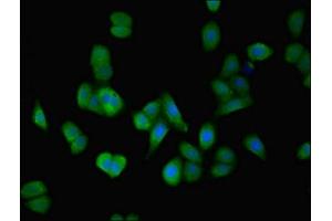 Immunofluorescent analysis of HepG2 cells using ABIN7150009 at dilution of 1:100 and Alexa Fluor 488-congugated AffiniPure Goat Anti-Rabbit IgG(H+L) (ATPBD4 antibody  (AA 8-267))