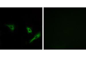 Peptide - +Immunohistochemistry analysis of paraffin-embedded human breast carcinoma tissue using ATG4A antibody. (ATG4A antibody)