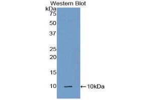 Western Blotting (WB) image for anti-Complement Component 5a (C5a) (AA 679-755) antibody (ABIN3208723) (C5A antibody  (AA 679-755))