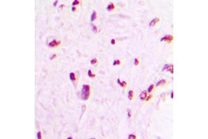 Immunohistochemistry (IHC) image for anti-Myocyte Enhancer Factor 2C (MEF2C) (C-Term) antibody (ABIN7300986)