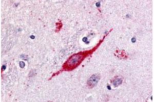 Immunohistochemical (Formalin/PFA-fixed paraffin-embedded sections) staining in human brain, neuron with GPR85 polyclonal antibody .