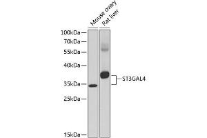 Western blot analysis of extracts of various cell lines, using ST3G antibody (ABIN6130192, ABIN6148529, ABIN6148531 and ABIN6217583) at 1:1000 dilution. (ST3GAL4 antibody  (AA 27-267))