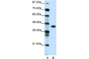 WB Suggested Anti-ZNF396 Antibody Titration:  0. (ZNF396 antibody  (Middle Region))