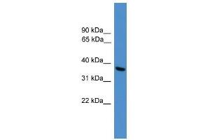 Western Blot showing UCHL5 antibody used at a concentration of 1-2 ug/ml to detect its target protein. (UCHL5 antibody  (C-Term))