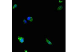 Immunofluorescence staining of Hela cells with ABIN7150717 at 1:233, counter-stained with DAPI. (MAP2K5 antibody  (AA 1-190))