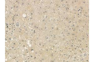 ABIN6265479 and ABIN6273328 at 1/100 staining human normal liver tissue by IHC-P. (TBC1D23 antibody  (Internal Region))