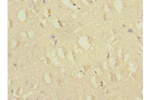 CACNG7 antibody  (AA 156-275)