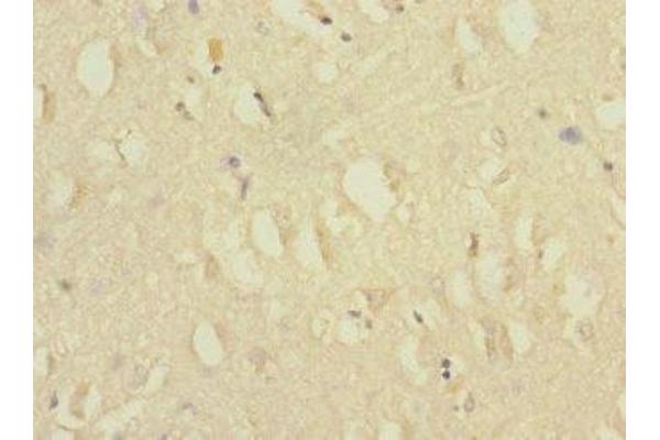 CACNG7 antibody  (AA 156-275)