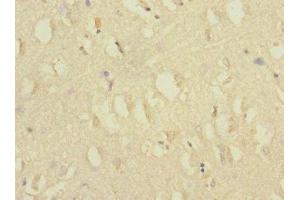 Immunohistochemistry of paraffin-embedded human brain tissue using ABIN7175576 at dilution of 1:100 (CACNG7 antibody  (AA 156-275))
