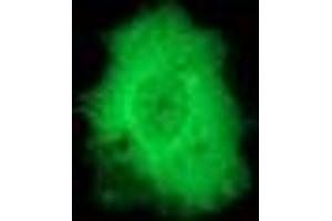 Image no. 3 for anti-Protein Phosphatase, Mg2+/Mn2+ Dependent, 1G (PPM1G) antibody (ABIN1500378) (PPM1G antibody)