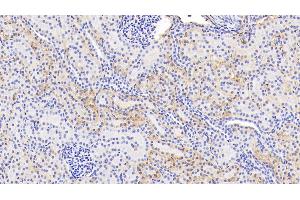 Detection of HbA1c in Human Kidney Tissue using Polyclonal Antibody to Glycated Hemoglobin A1c (HbA1c) (HbA1c antibody)