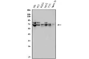 Western blot analysis of FRMD6 using anti-FRMD6 antibody (ABIN7599577). (FRMD6 antibody  (AA 1-95))