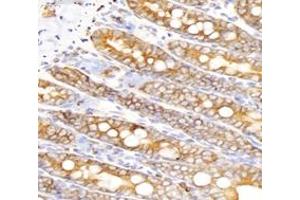 Immunohistochemistry analysis of paraffin-embedded rat small intestine using,INSR (ABIN7074298) at dilution of 1: 6000 (ISR-alpha antibody)