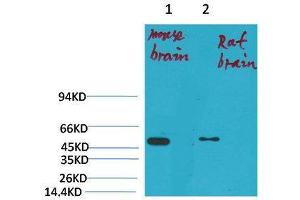 Western Blot (WB) analysis of 1) Mouse Brain Tissue, 2)Rat Brain Tissue with KV1. (Kv1.1 Potassium Channel antibody)