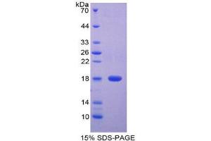SDS-PAGE (SDS) image for Cytotoxic T-Lymphocyte-Associated Protein 4 (CTLA4) (AA 41-192) protein (His tag) (ABIN2124592)