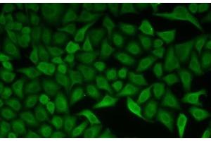 Immunofluorescence analysis of HeLa cells using CDC34 Polyclonal Antibody (CDC34 antibody)