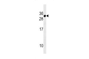 Western blot analysis in MDA-MB453 cell line lysates (35ug/lane). (CD300E antibody  (AA 48-76))