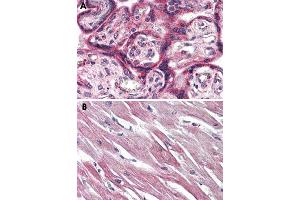 Immunohistochemical staining of formalin-fixed, paraffin-embedded human placenta (A) and human heart (B) tissue after heat-induced antigen retrieval. (EPHX2 antibody  (C-Term))
