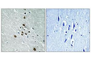 Immunohistochemical analysis of paraffin-embedded human brain tissue using SF1 (Phospho-Ser82) antibody (left)or the same antibody preincubated with blocking peptide (right). (Splicing Factor 1 antibody  (pSer82))
