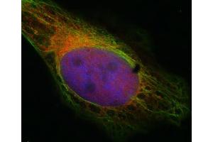 Indirect immunostaining of HELA cells with anti-syntaxin 7 (dilution 1 : 100; red) and mouse anti-α-tubulin (ABIN1742547, dilution 1 : 100; green).