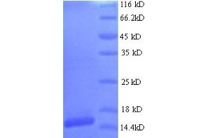 SDS-PAGE (SDS) image for Human Papilloma Virus 16 E7 (HPV-16 E7) (AA 1-105), (full length) protein (His tag) (ABIN5714208) (HPV16 E7 Protein (AA 1-105, full length) (His tag))