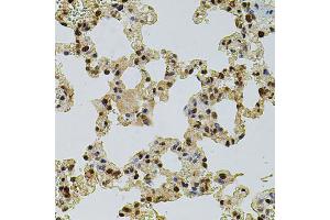 Immunohistochemistry of paraffin-embedded rat lung using CREBBP antibody (ABIN2736578) at dilution of 1:100 (40x lens). (CBP antibody)