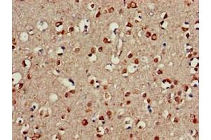 Immunohistochemistry of paraffin-embedded human brain tissue using ABIN7147214 at dilution of 1:100 (CDC42EP3 antibody  (AA 1-226))