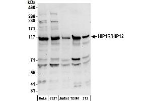 anti-Huntingtin Interacting Protein 1 Related (HIP1R) (AA 1-50) antibody
