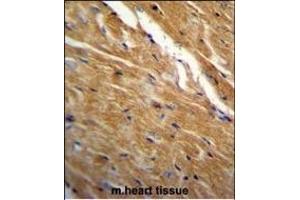 TBC1D13 Antibody (Center) (ABIN655819 and ABIN2845243) immunohistochemistry analysis in formalin fixed and paraffin embedded mouse heart tissue followed by peroxidase conjugation of the secondary antibody and DAB staining. (TBC1D13 antibody  (AA 76-105))