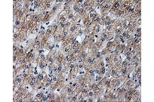 Immunohistochemical staining of paraffin-embedded liver tissue using anti-ANXA10mouse monoclonal antibody. (Annexin a10 antibody)