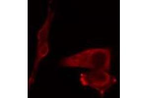 ABIN6269002 staining COLO205 cells by IF/ICC. (COL2A1 antibody  (N-Term))
