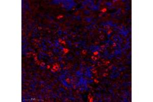 Immunofluorescence of paraffin embedded mouse spleen using MS4A2 (ABIN7074594) at dilution of 1: 400 (350x lens)