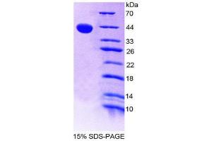 SDS-PAGE (SDS) image for Eosinophil Chemotactic Factor (ECF) (AA 24-97) protein (His tag,GST tag) (ABIN1980607) (ECF Protein (AA 24-97) (His tag,GST tag))