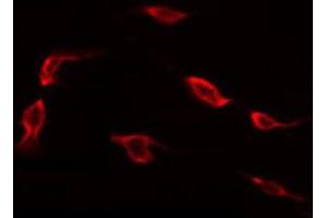 ABIN6272391 staining 293 by IF/ICC. (MRPL41 antibody)
