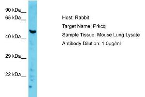 Host: Rabbit Target Name: Prkcq Sample Type: Mouse Lung lysates Antibody Dilution: 1. (PKC theta antibody  (C-Term))