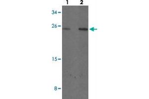 Western blot analysis of MYCT1 in rat lung tissue with MYCT1 polyclonal antibody  at (1) 1 and (2) 2 ug/mL. (Myc Target 1 antibody  (C-Term))
