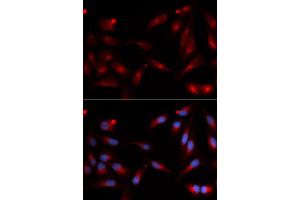 Immunofluorescence (IF) image for anti-ADAM Metallopeptidase Domain 9 (ADAM9) antibody (ABIN1876576) (ADAM9 antibody)