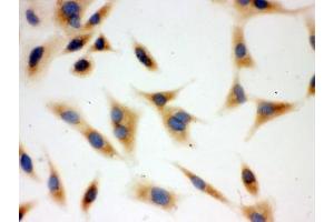 Immunocytochemistry (ICC) image for anti-BCL2-Antagonist/killer 1 (BAK1) (AA 22-211) antibody (ABIN4950296)