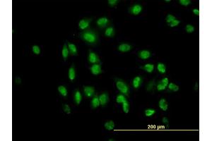 Immunofluorescence of monoclonal antibody to TULP2 on HeLa cell. (TULP2 antibody  (AA 141-250))